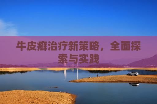 牛皮癣治疗新策略，全面探索与实践